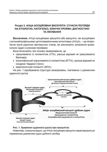 АНЦА-асоційовані васкуліти. Катеренчук І.П., Гуцаленко O.O., Ярмола T.І. - фото 6