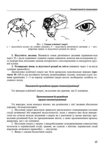 Анестезіологія та інтенсивна терапія. Підручник. 4-е видання - фото 6